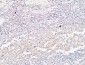 BMP-15 Polyclonal Antibody